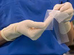 Exploring the Use of Mesh in Medical Procedures
